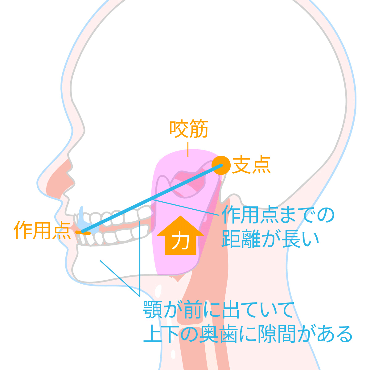 タンピローの食いしばり治療