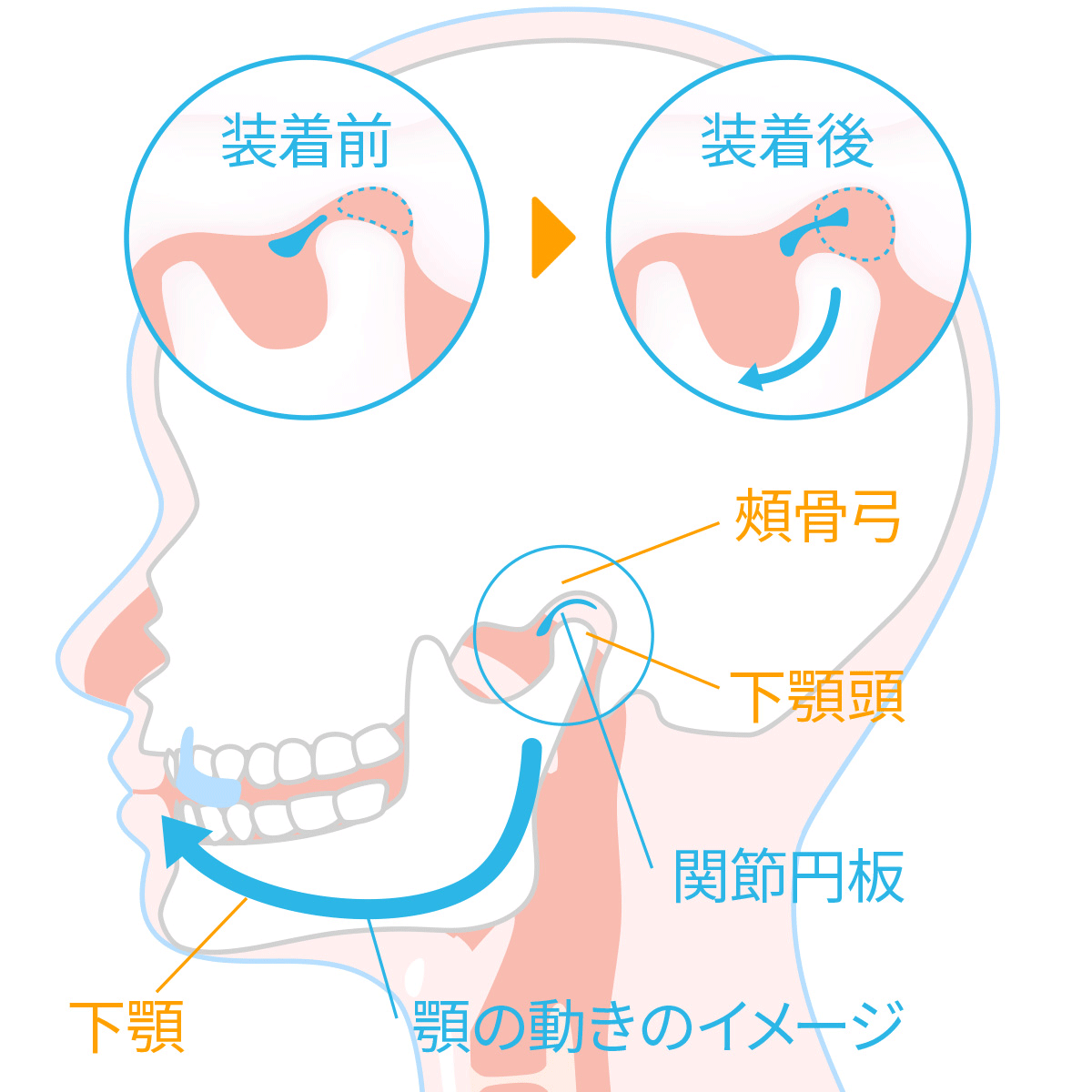 タンピローの顎関節症治療